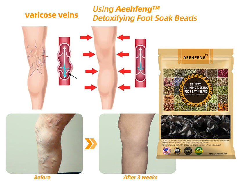 Aeehfeng™ 30-Herb Slimming & Detox Foot - (👩‍⚕️AVLS Certifikace)