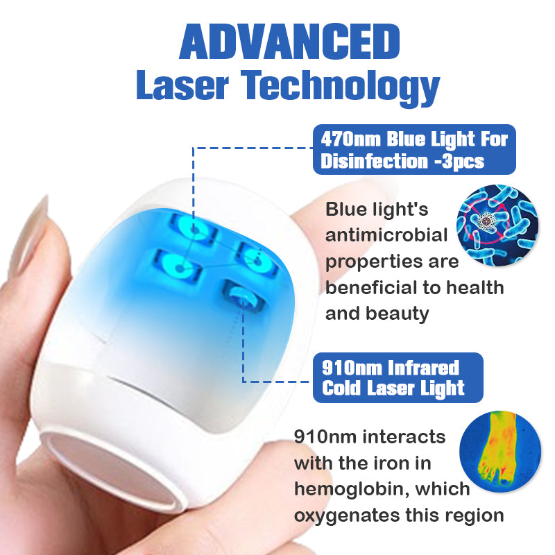 (🔥LIMITOVANÁ SLEVA 70% - POSLEDNÍ DEN🔥)Furzero™ Laserové zařízení na odstranění plísně nehtů